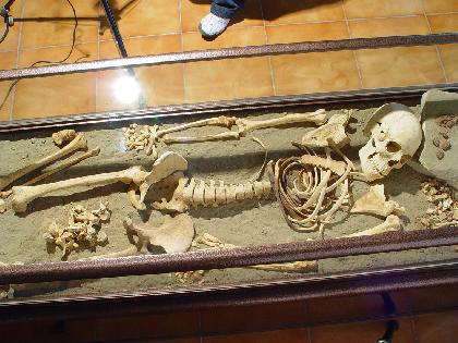 Museo de la Historia de la Medicina